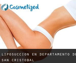 Liposucción en Departamento de San Cristóbal