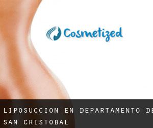 Liposucción en Departamento de San Cristóbal