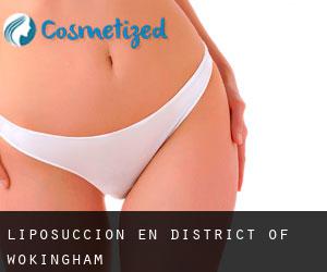 Liposucción en District of Wokingham