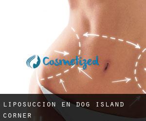 Liposucción en Dog Island Corner