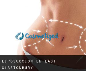 Liposucción en East Glastonbury