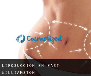 Liposucción en East Williamston