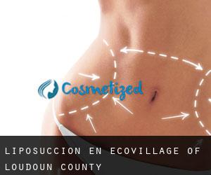 Liposucción en EcoVillage of Loudoun County