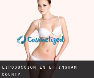 Liposucción en Effingham County