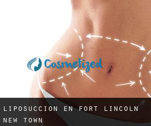 Liposucción en Fort Lincoln New Town