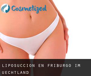 Liposucción en Friburgo im Üechtland