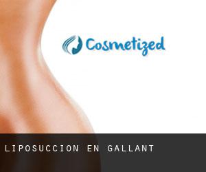 Liposucción en Gallant