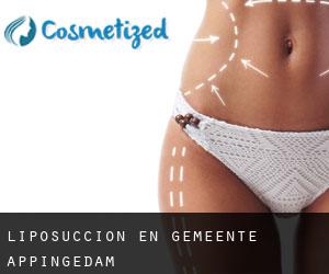 Liposucción en Gemeente Appingedam