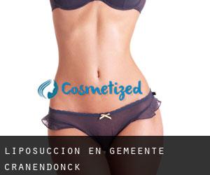 Liposucción en Gemeente Cranendonck