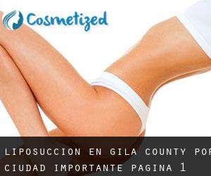 Liposucción en Gila County por ciudad importante - página 1