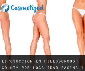 Liposucción en Hillsborough County por localidad - página 1