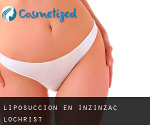 Liposucción en Inzinzac-Lochrist
