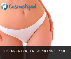 Liposucción en Jennings Yard