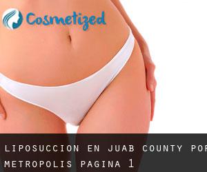 Liposucción en Juab County por metropolis - página 1