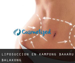 Liposucción en Kampong Baharu Balakong