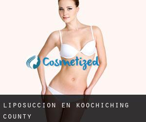 Liposucción en Koochiching County