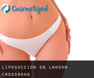 Liposucción en Lawson Crossroad