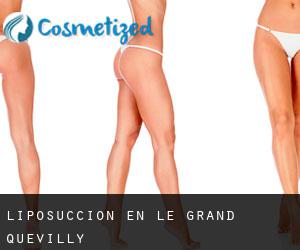 Liposucción en Le Grand-Quevilly