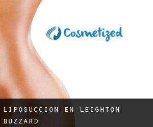 Liposucción en Leighton Buzzard