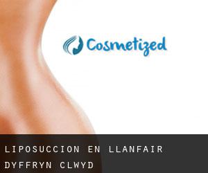 Liposucción en Llanfair-Dyffryn-Clwyd