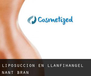 Liposucción en Llanfihangel-Nant-Brân