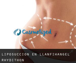Liposucción en Llanfihangel Rhydithon
