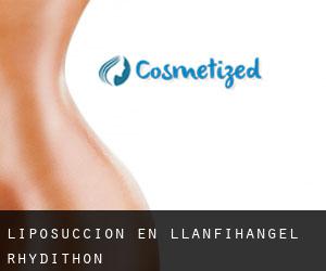 Liposucción en Llanfihangel Rhydithon