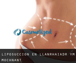 Liposucción en Llanrhaiadr-ym-Mochnant
