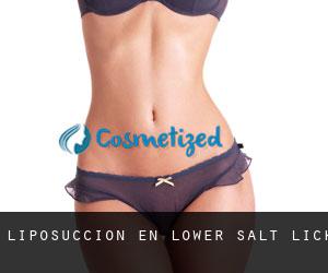 Liposucción en Lower Salt Lick
