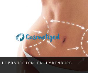 Liposucción en Lydenburg