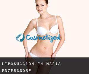 Liposucción en Maria Enzersdorf