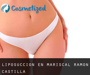 Liposucción en Mariscal Ramon Castilla