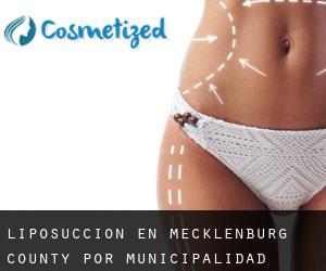 Liposucción en Mecklenburg County por municipalidad - página 1