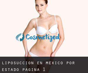 Liposucción en México por Estado - página 1