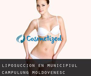 Liposucción en Municipiul Câmpulung Moldovenesc