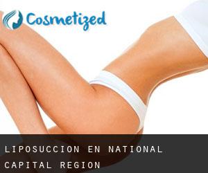 Liposucción en National Capital Region