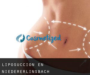 Liposucción en Niedererlinsbach
