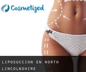 Liposucción en North Lincolnshire