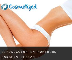 Liposucción en Northern Borders Region