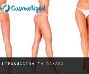 Liposucción en Oaxaca