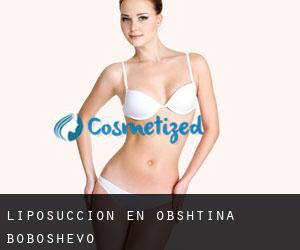 Liposucción en Obshtina Boboshevo