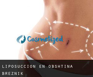Liposucción en Obshtina Breznik