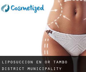 Liposucción en OR Tambo District Municipality