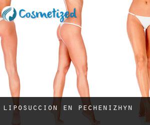 Liposucción en Pechenizhyn