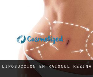 Liposucción en Raionul Rezina