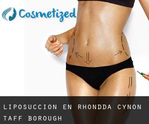 Liposucción en Rhondda Cynon Taff (Borough)