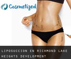 Liposucción en Richmond Lake Heights Development