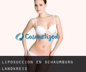 Liposucción en Schaumburg Landkreis