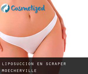 Liposucción en Scraper-Moecherville