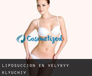 Liposucción en Velykyy Klyuchiv